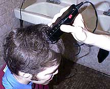 Logan initial baldness